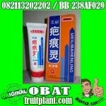 PENGHILANG BEKAS LUKA MEILI BAHENLING [082113202202/BB 238AF029] OBAT LUKA HERBaL