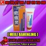 MEILI BAHENLING KRIM AMPUH MENGHILANKAN BEKAS LUKA DI TUBUH 081316077399 / 28DC4599