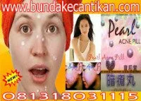 OBAT JERAWAT (ACNE PIL) SEMBUHKAN JERAWAT SECARA CEPAT CALL 081318031115